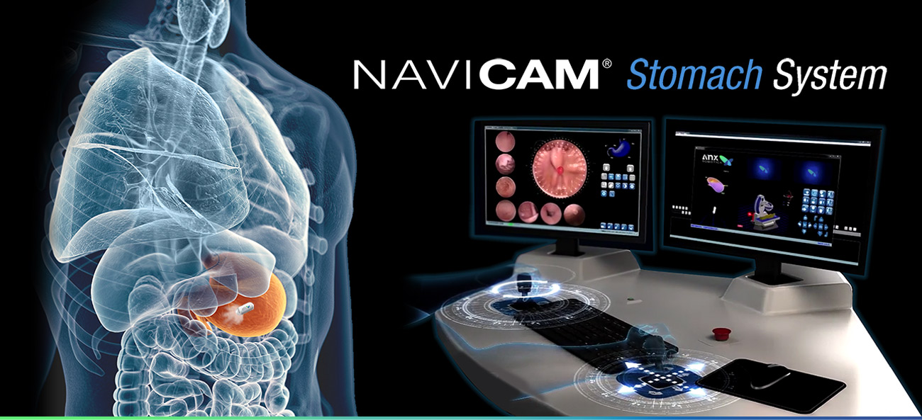 NaviCAM Stomach System