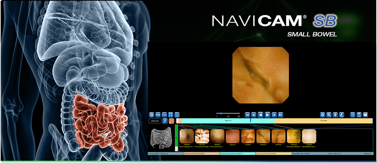 NaviCAM Small Bowel