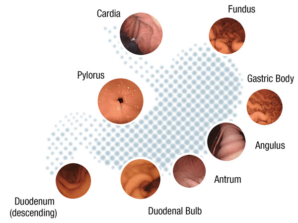 Stomach Capsule 360 Robotic Controlled