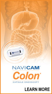 NaviCam Colon