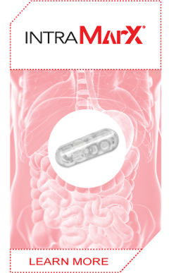 IntraMarX