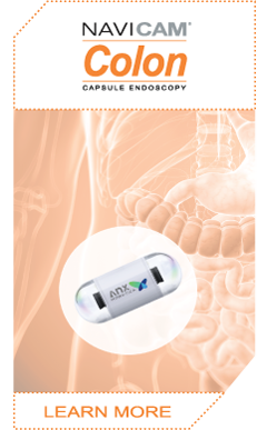 Navicam Colon